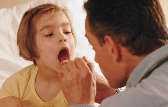 Angina em crianças: sintomas e tratamento